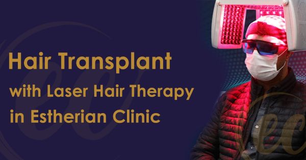 How Laser Therapy Can Improve the Appearance of Your Hair Transplant and Curb Post-Hair Transplant Regrowth: A Complete Guide
